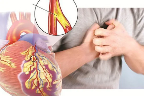 Uống nước gì tốt cho tim mạch 2 thưc-uong-chua-benh-tim-mach